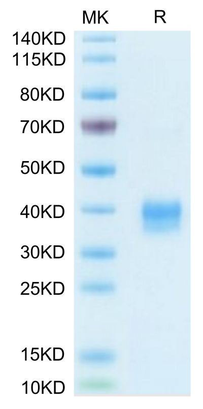 Biotinylated Mouse Siglec-15/CD33L3 on Tris-Bis PAGE under reduced condition. The purity is greater than 95%.