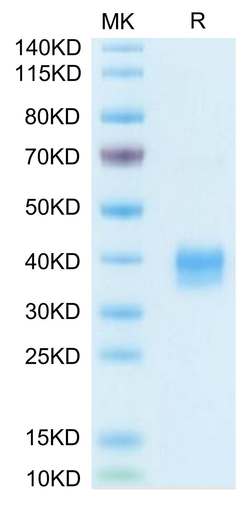 Biotinylated Mouse Siglec-15/CD33L3 on Tris-Bis PAGE under reduced condition. The purity is greater than 95%.