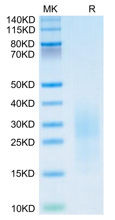 Mouse PSCA on Tris-Bis PAGE under reduced condition. The purity is greater than 95%.