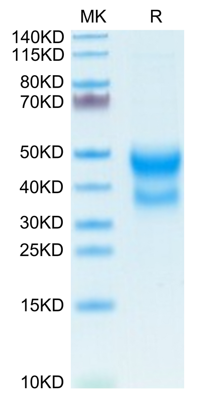 Mouse CD300A on Tris-Bis PAGE under reduced condition. The purity is greater than 95%.