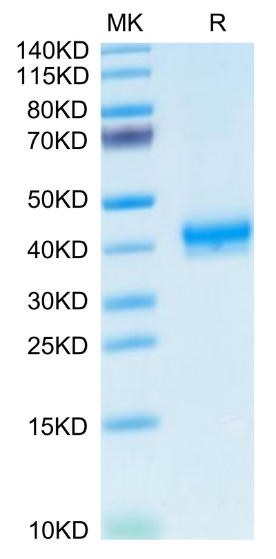 Human CADM3 on Tris-Bis PAGE under reduced condition. The purity is greater than 95%.