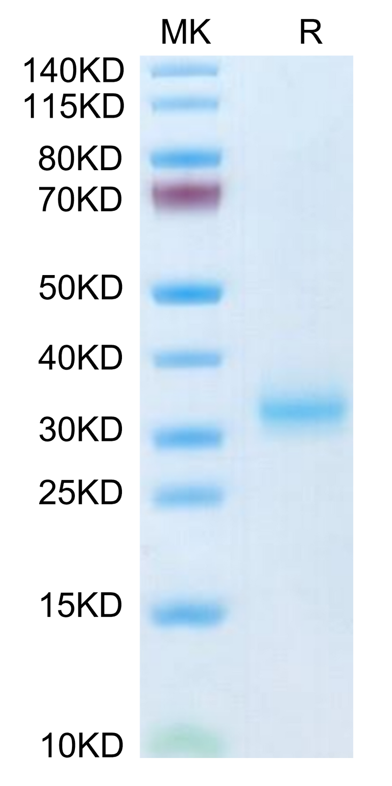 Mouse Adiponectin/Acrp30 on Tris-Bis PAGE under reduced condition. The purity is greater than 95%.