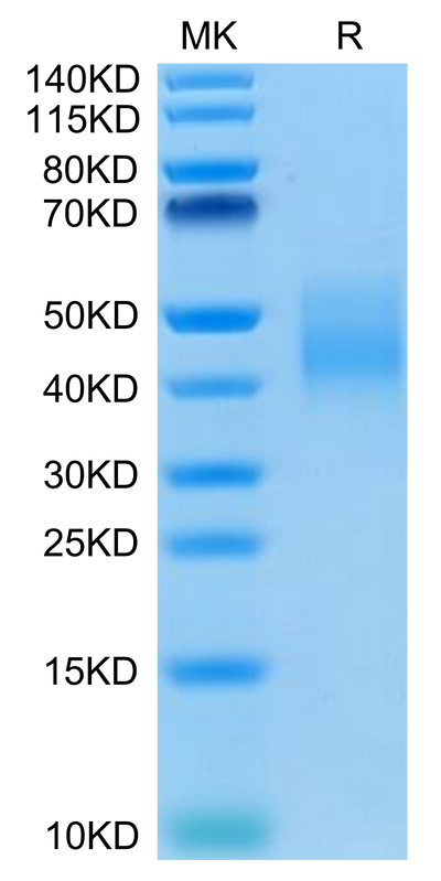 Human IL-10 R alpha on Tris-Bis PAGE under reduced condition. The purity is greater than 95%.