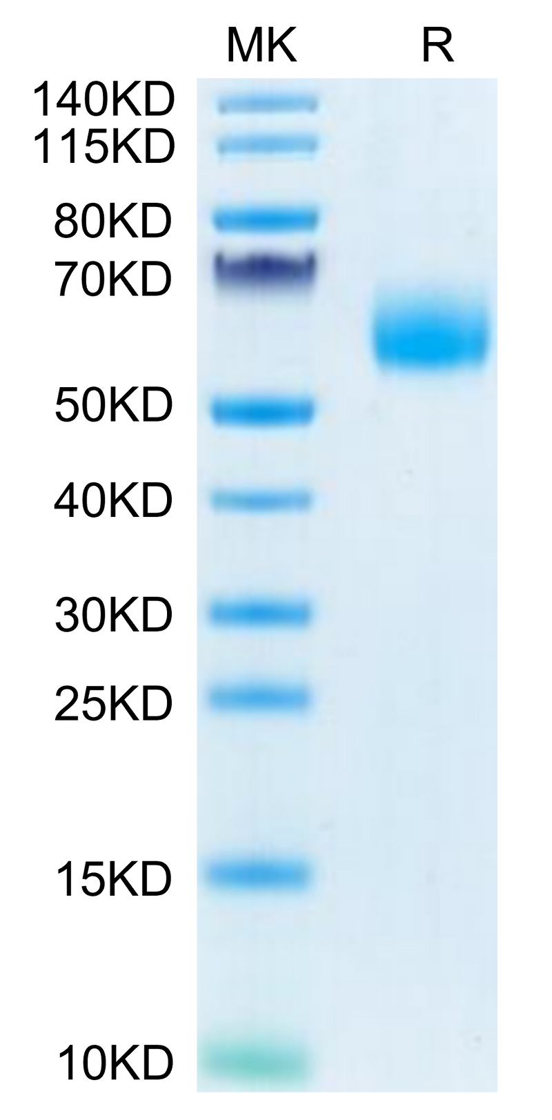 Human IL-1 Rrp2 (C154S,C262S) on Tris-Bis PAGE under reduced condition. The purity is greater than 95%.