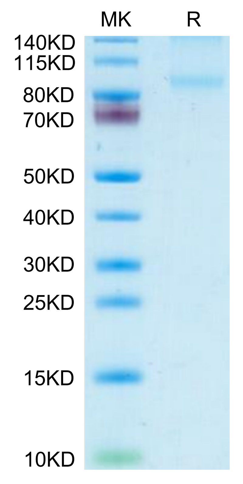 Mouse CD31/PECAM-1 on Tris-Bis PAGE under reduced condition. The purity is greater than 95%.