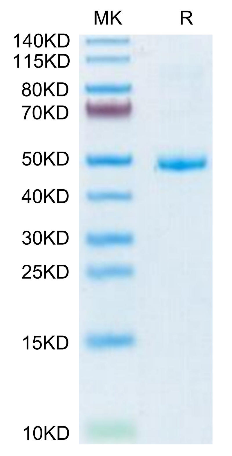 Human CD42a on Tris-Bis PAGE under reduced condition. The purity is greater than 95%.