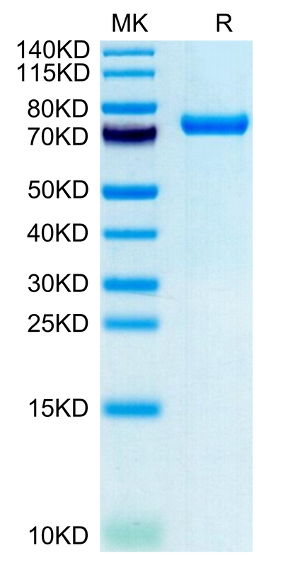 Human CLEC2D on Tris-Bis PAGE under reduced condition. The purity is greater than 95%.