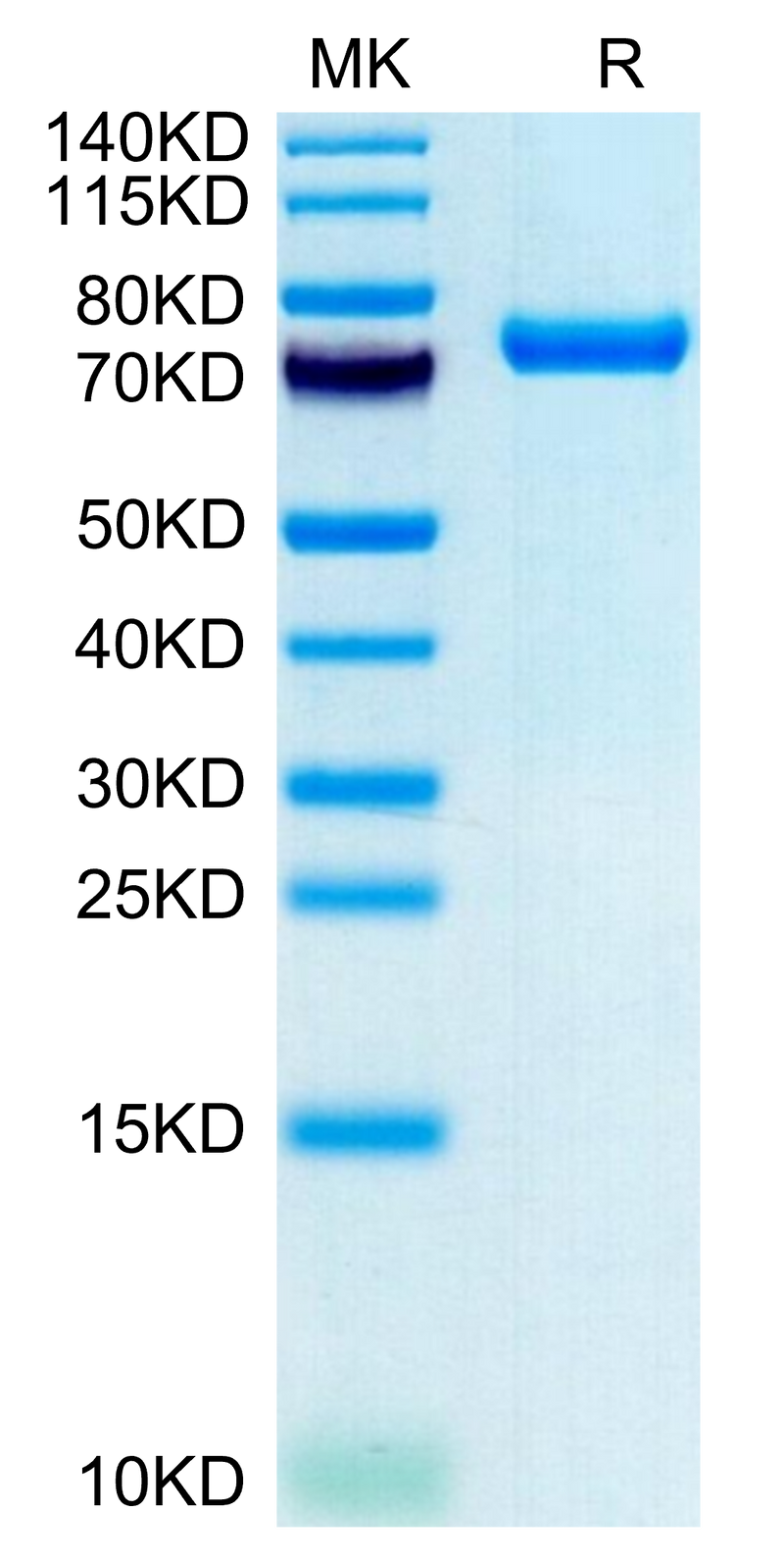 Human CLEC2D on Tris-Bis PAGE under reduced condition. The purity is greater than 95%.