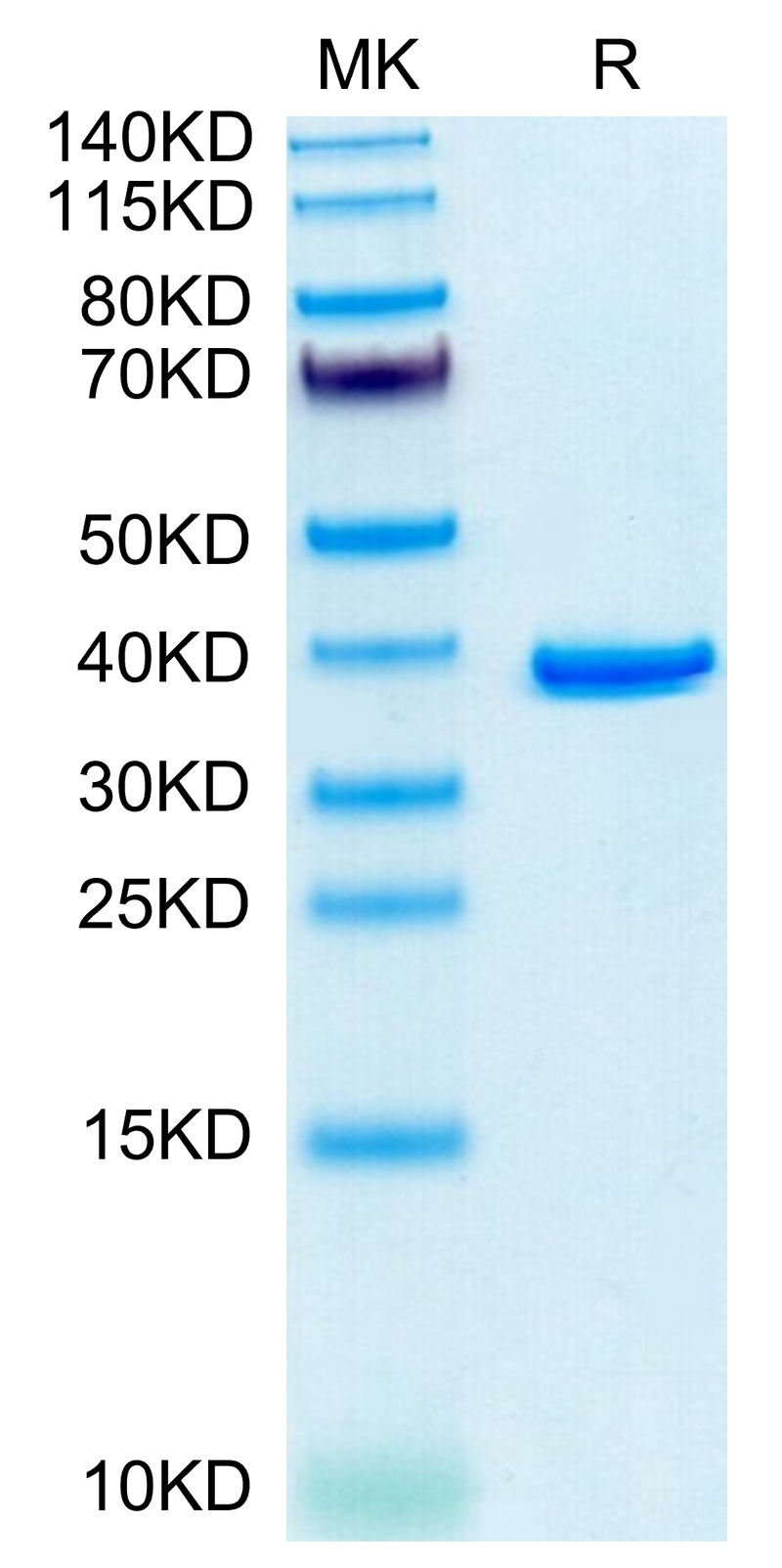 Human ANXA2 on Tris-Bis PAGE under reduced condition. The purity is greater than 95%.