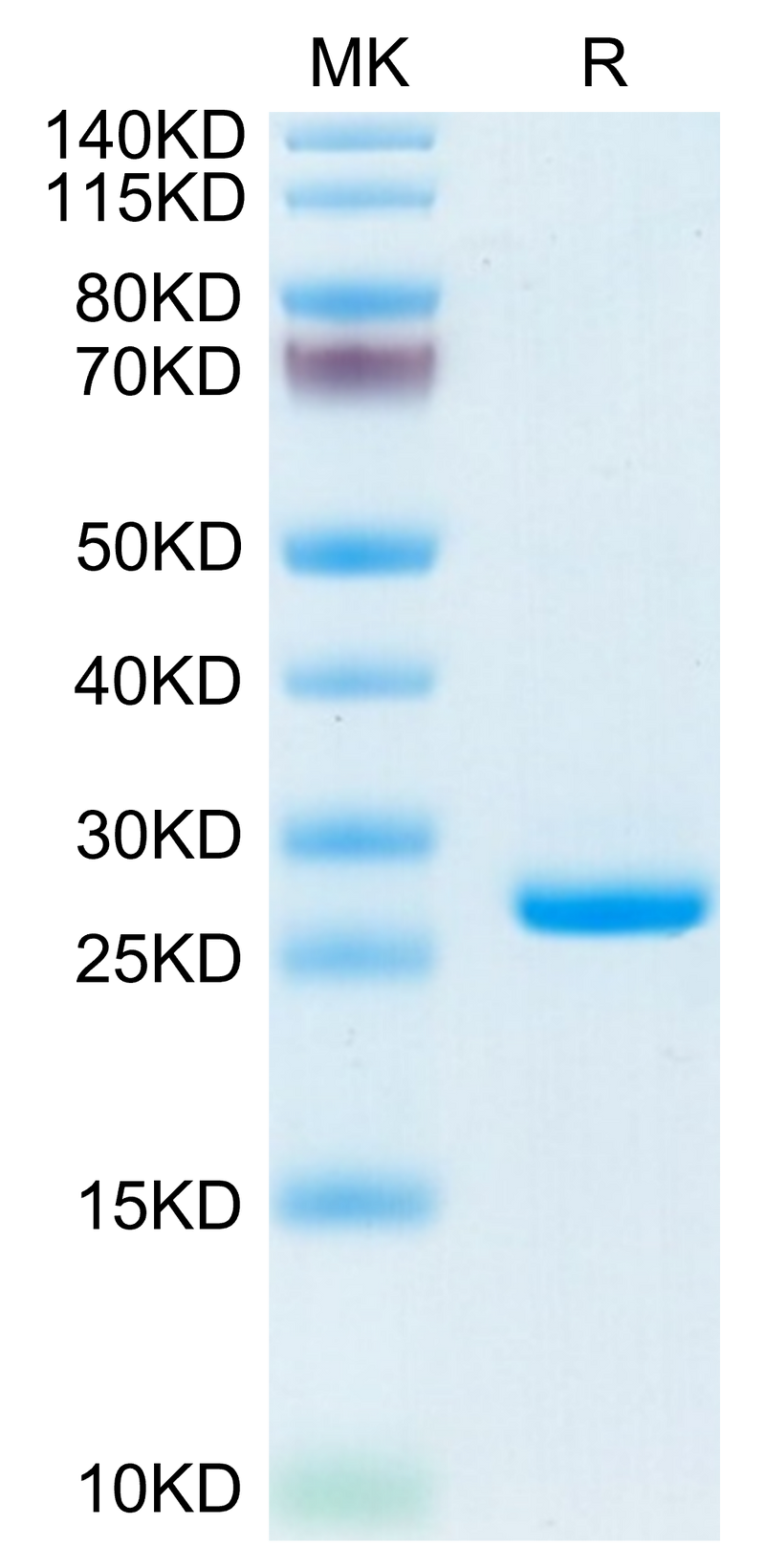 Mouse CRP on Tris-Bis PAGE under reduced condition. The purity is greater than 95%.