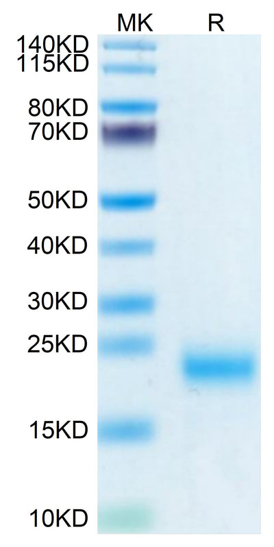 Human/Cynomolgus/Rhesus macaque ROR1 (165-305, Frizzled Domain) on Tris-Bis PAGE under reduced condition. The purity is greater than 95%.