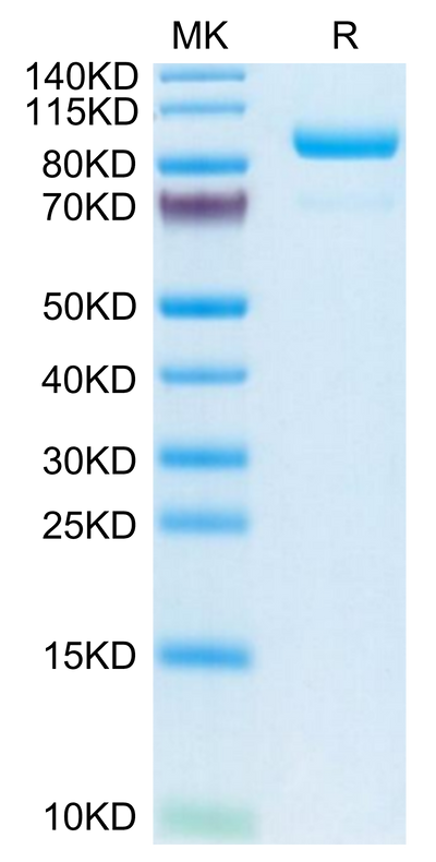 Human Complement Component C2 on Tris-Bis PAGE under reduced condition. The purity is greater than 95%.