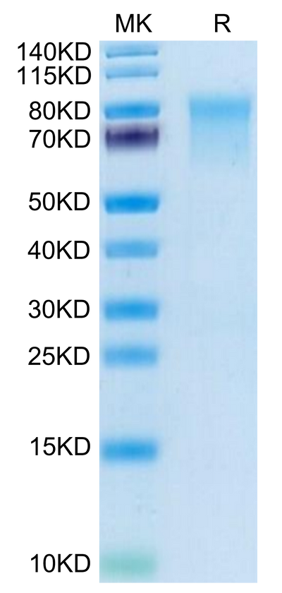 Mouse IL-15RA on Tris-Bis PAGE under reduced condition. The purity is greater than 95%.