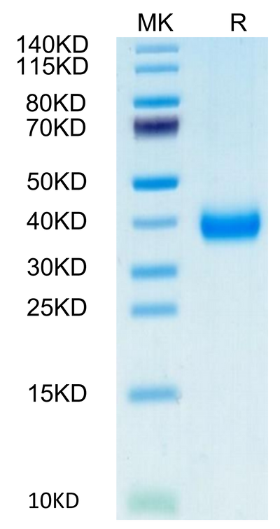 Biotinylated Cynomolgus CD161 on Tris-Bis PAGE under reduced condition. The purity is greater than 95%.