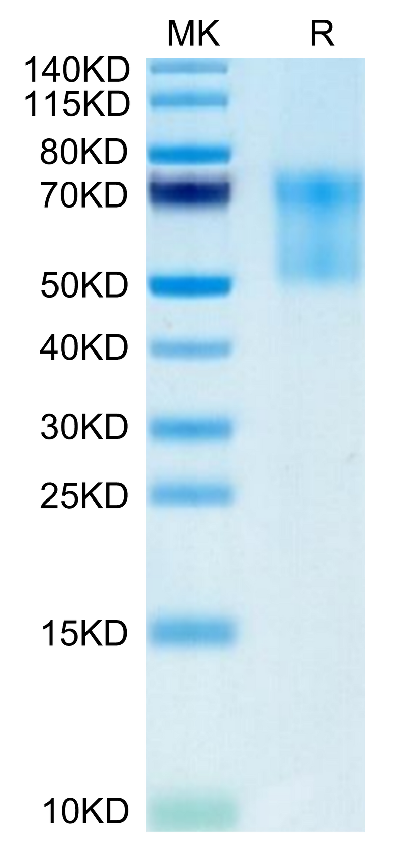 Biotinylated Human Syndecan-1 on Tris-Bis PAGE under reduced condition. The purity is greater than 95%.