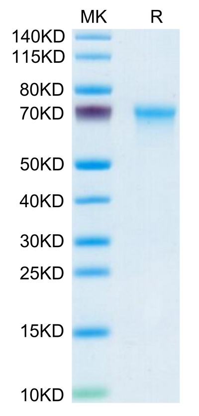 Mouse CXCL16 on Tris-Bis PAGE under reduced condition. The purity is greater than 95%.