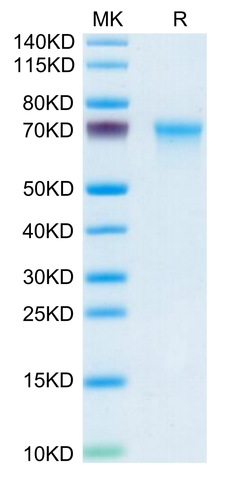 Mouse CXCL16 on Tris-Bis PAGE under reduced condition. The purity is greater than 95%.