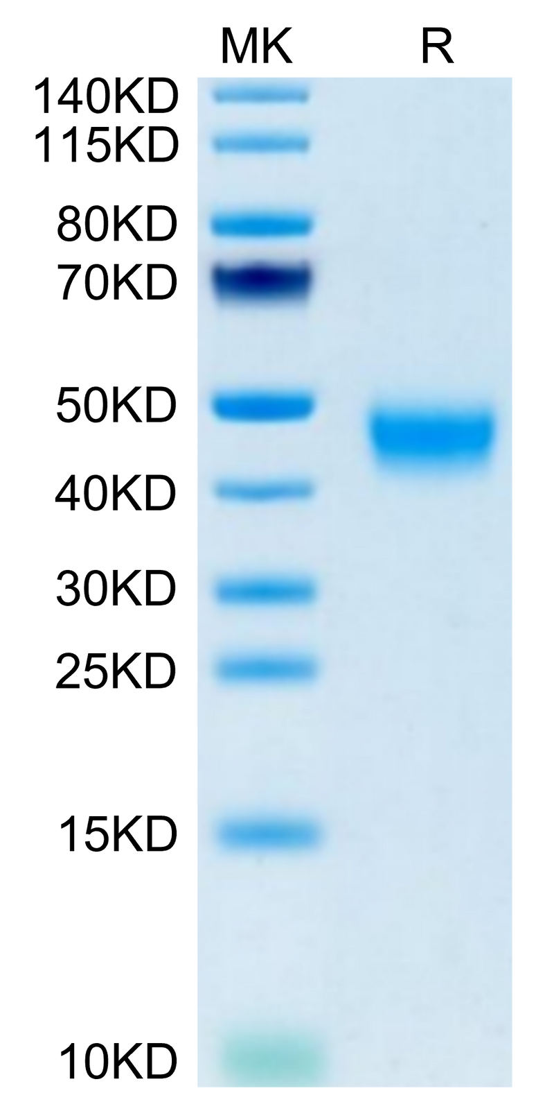 Mouse GPA34/VSIG1 on Tris-Bis PAGE under reduced condition. The purity is greater than 95%.