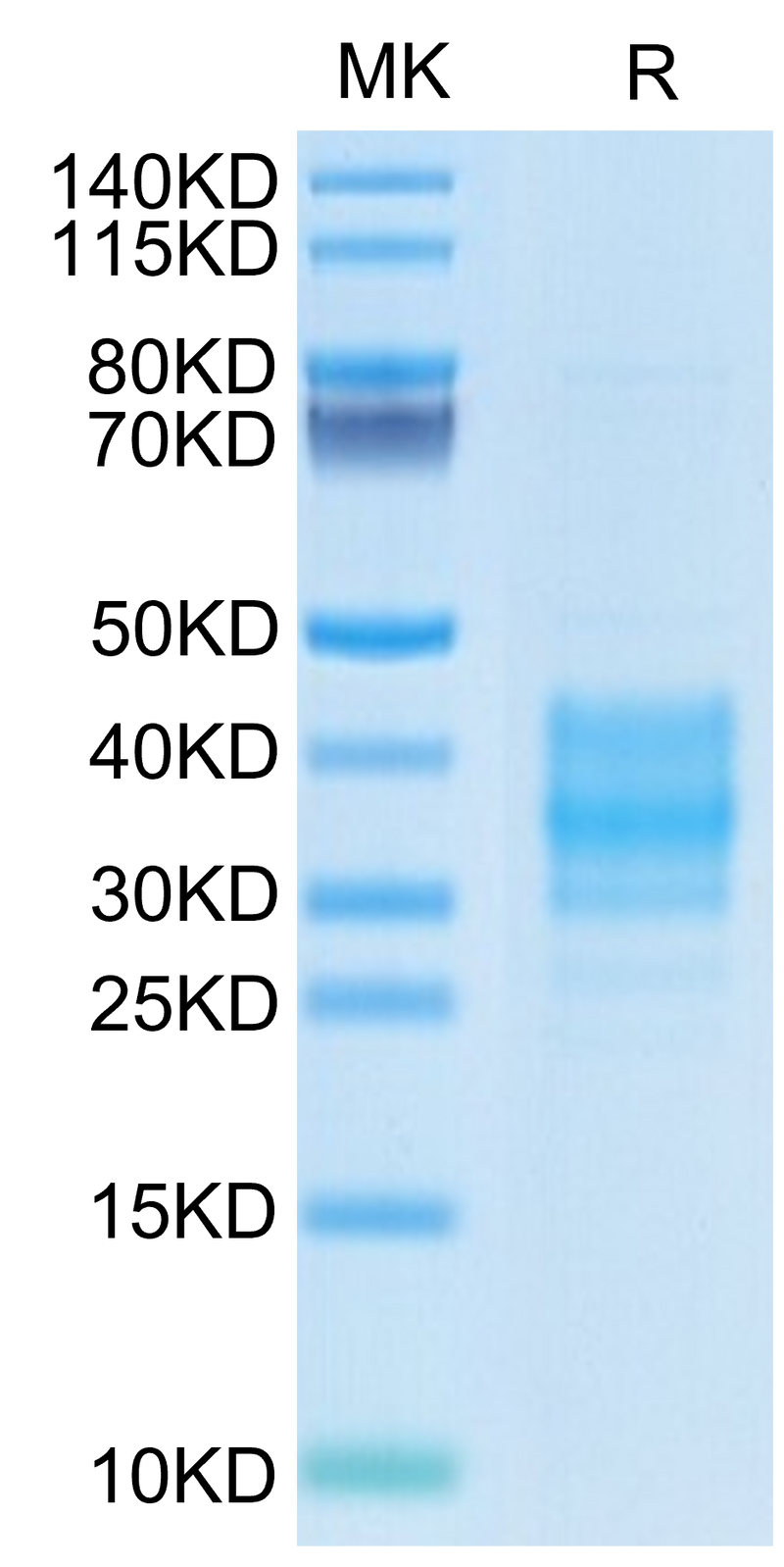 Cynomolgus FOLR2 on Tris-Bis PAGE under reduced condition. The purity is greater than 95%.