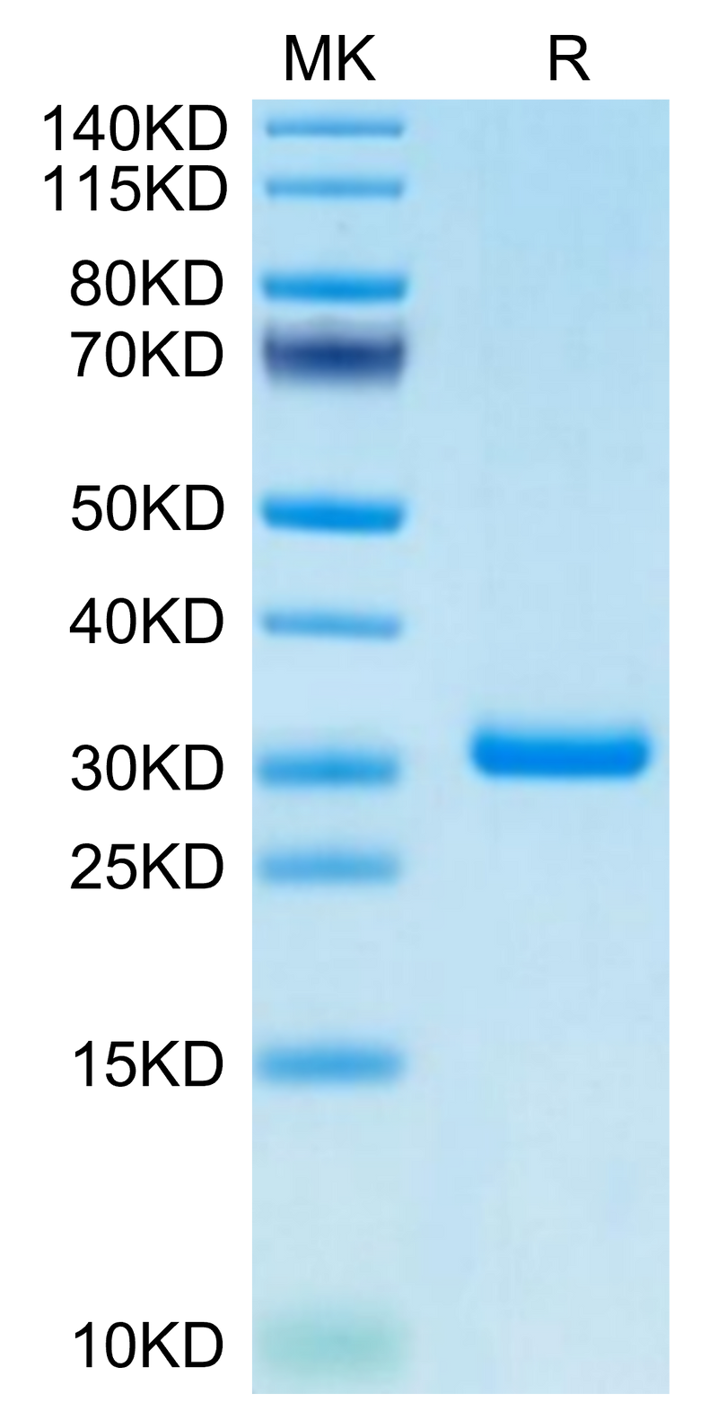 Cynomolgus BTN3A1 on Tris-Bis PAGE under reduced condition. The purity is greater than 95%.