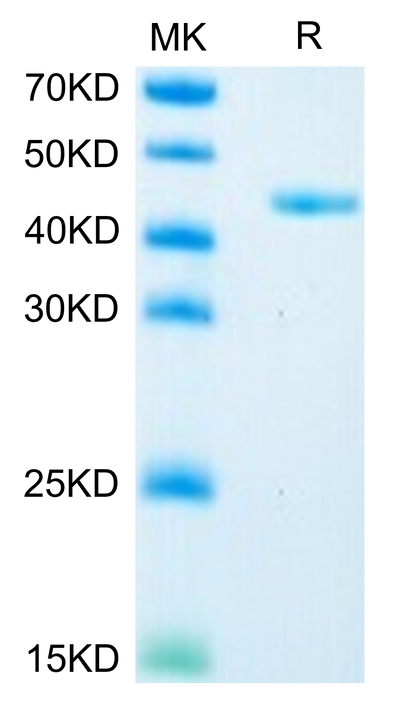 Mouse Glypican 2/GPC2 on Tris-Bis PAGE under reduced condition. The purity is greater than 95%.