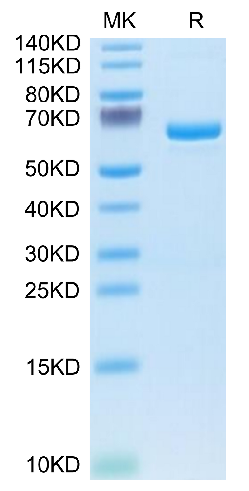 Human APOE4 on Tris-Bis PAGE under reduced condition. The purity is greater than 95%.