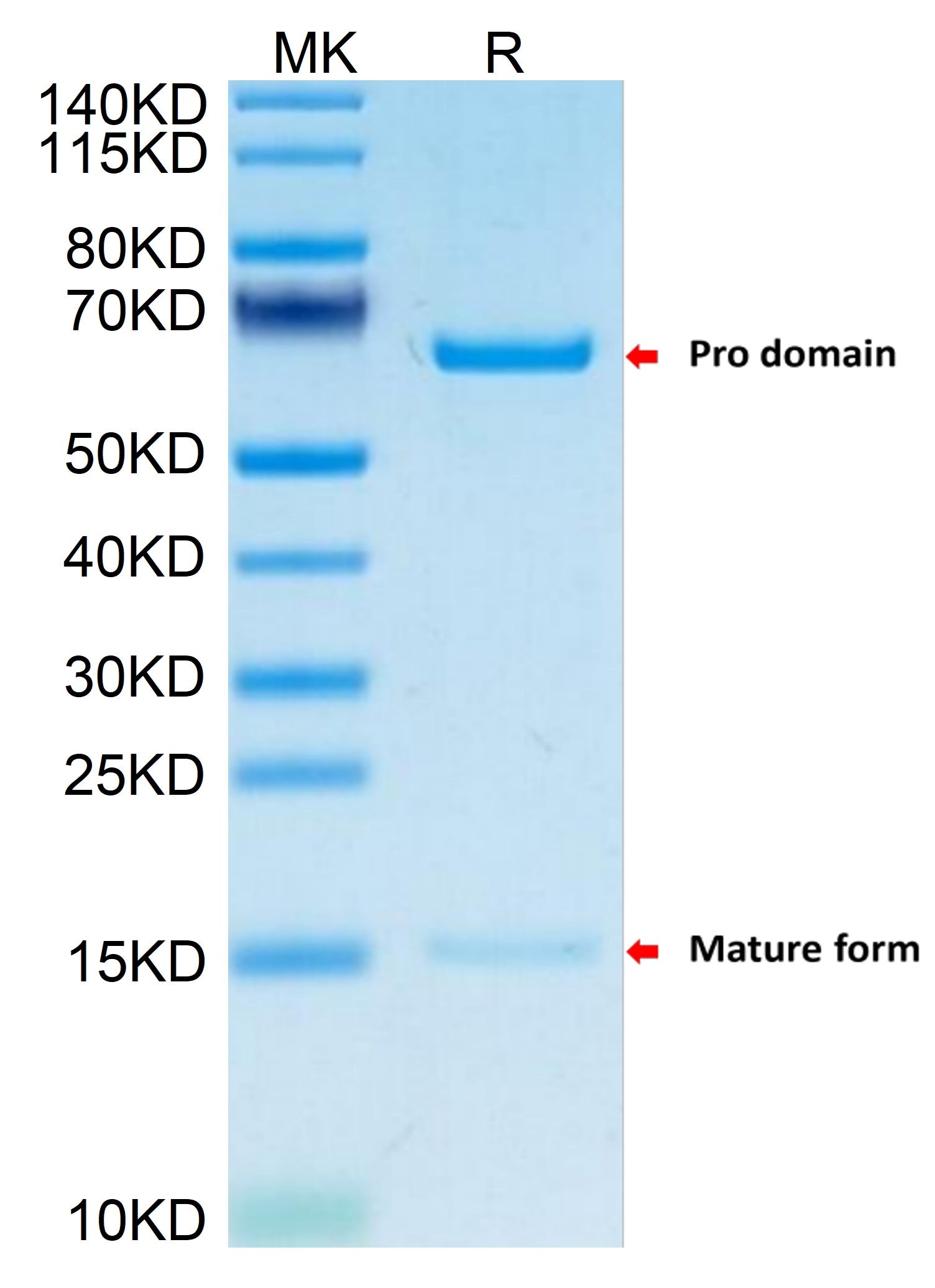 Recombinant Mouse PCSK9 Protein, Active - High Quality | Beta LifeScience