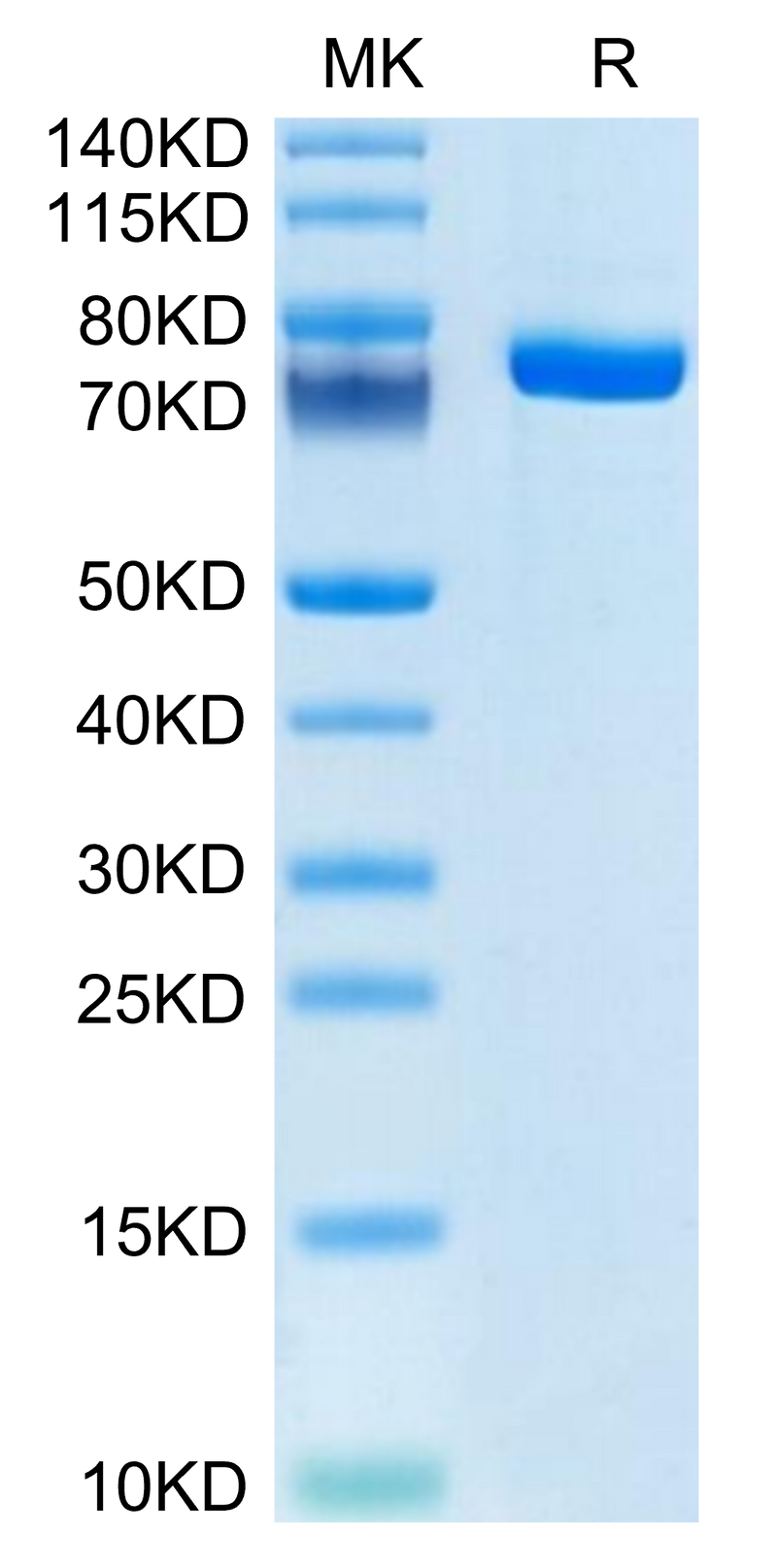 Human Coagulation factor XI on Tris-Bis PAGE under reduced condition. The purity is greater than 95%.