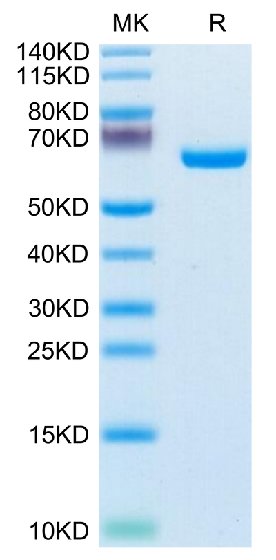 Human EphB3 on Tris-Bis PAGE under reduced condition. The purity is greater than 95%.