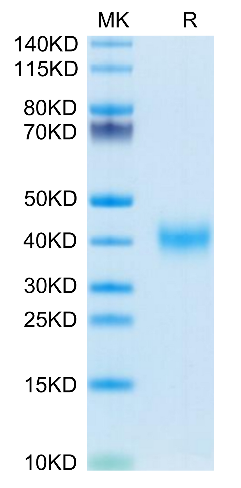 Mouse CLEC10A on Tris-Bis PAGE under reduced condition. The purity is greater than 95%.