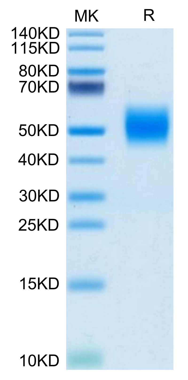 Biotinylated Human FGFR2 beta (IIIc) on Tris-Bis PAGE under reduced condition. The purity is greater than 95%.