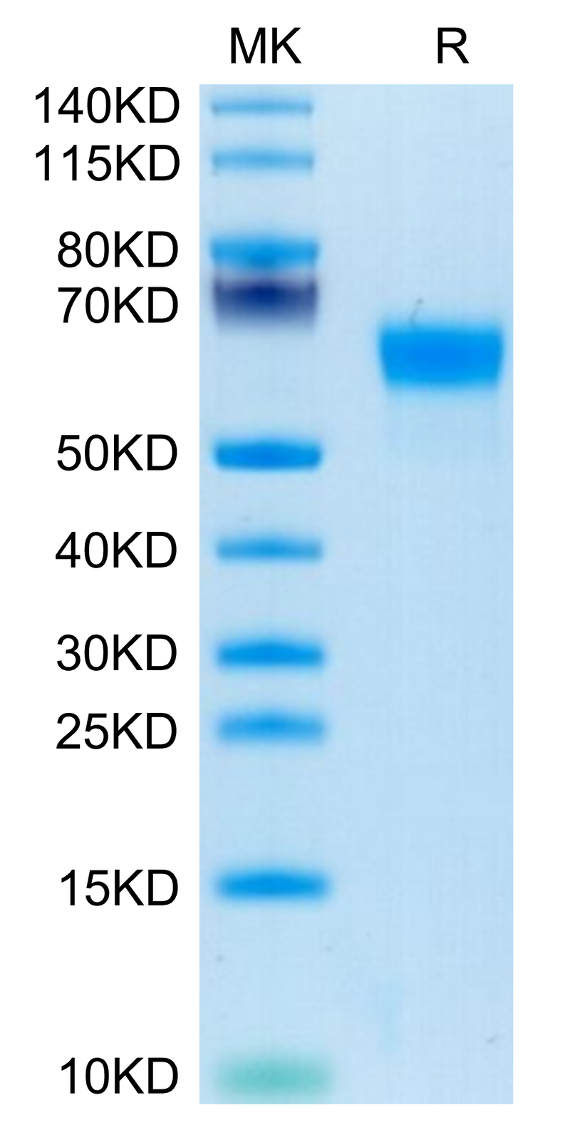 Human Factor H on Tris-Bis PAGE under reduced condition. The purity is greater than 95%.