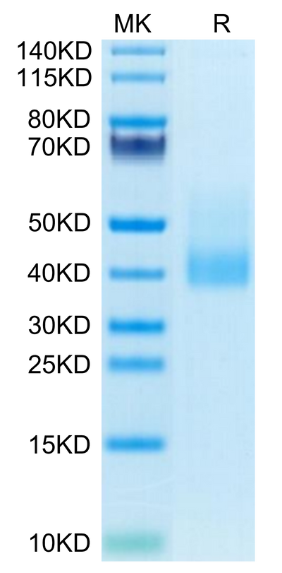 Human CLEC10A on Tris-Bis PAGE under reduced condition. The purity is greater than 95%.