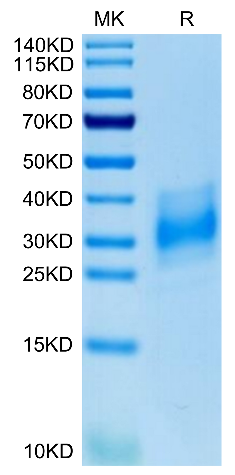 Human EMMPRIN on Tris-Bis PAGE under reduced condition. The purity is greater than 95%.