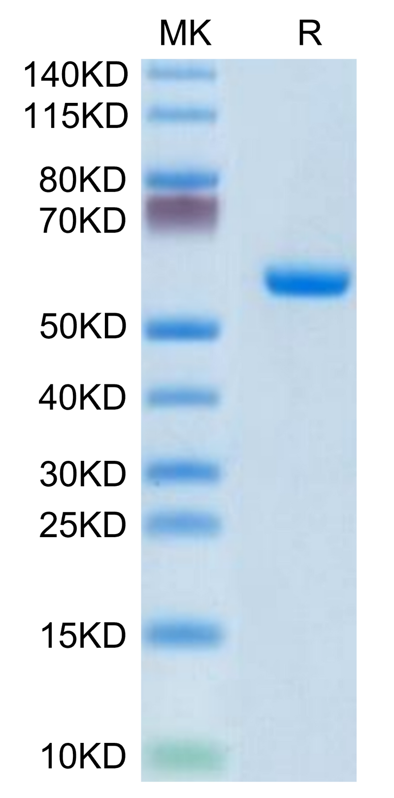 Human CLEC4A on Tris-Bis PAGE under reduced condition. The purity is greater than 95%.