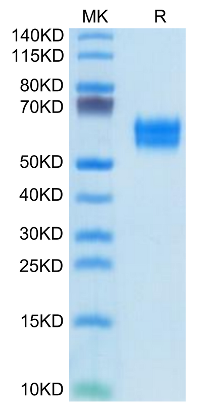 Human IL-1R1 on Tris-Bis PAGE under reduced condition. The purity is greater than 95%.