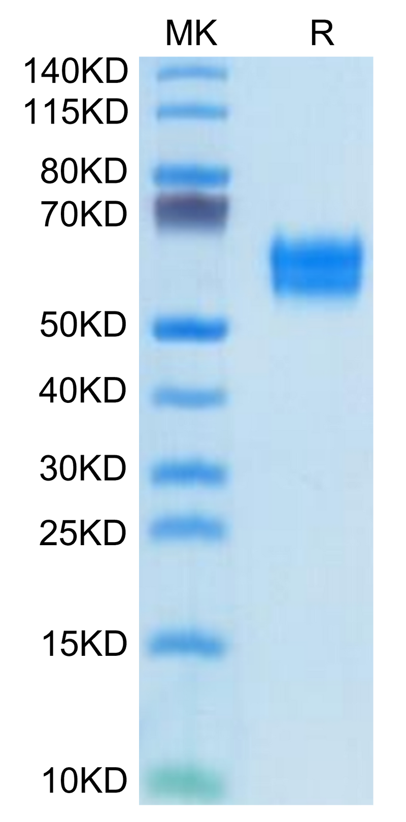 Human IL-1R1 on Tris-Bis PAGE under reduced condition. The purity is greater than 95%.