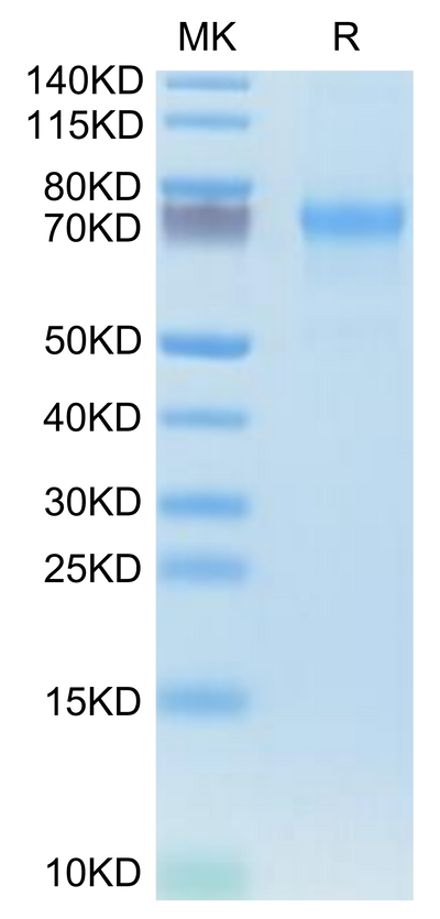 Human CXCL16 on Tris-Bis PAGE under reduced condition. The purity is greater than 95%.