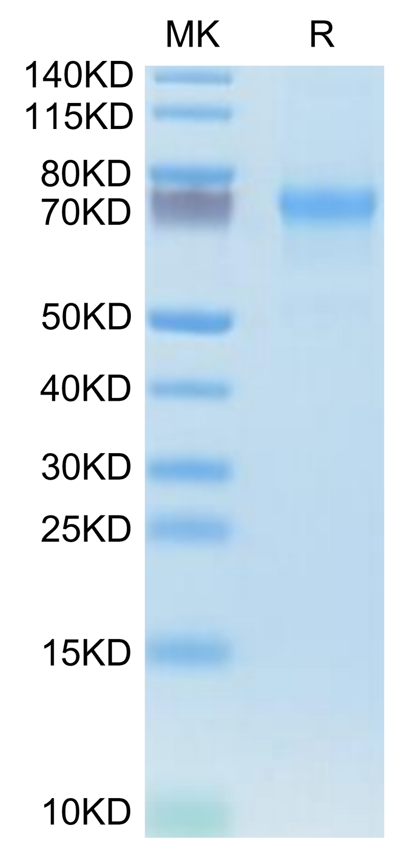 Human CXCL16 on Tris-Bis PAGE under reduced condition. The purity is greater than 95%.