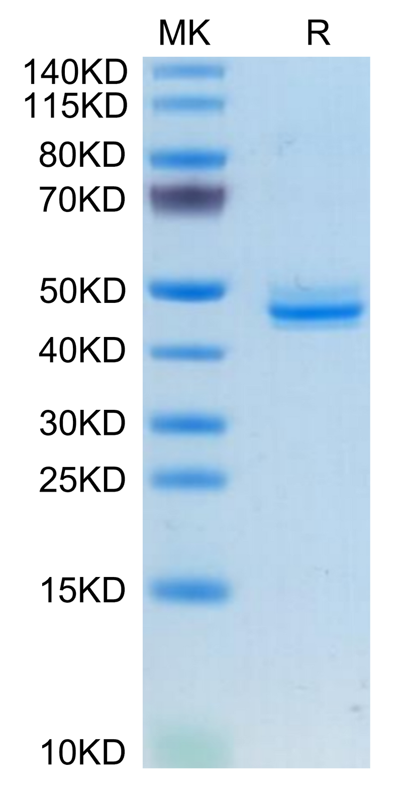 Human CALCA/CGRP on Tris-Bis PAGE under reduced condition. The purity is greater than 95%.