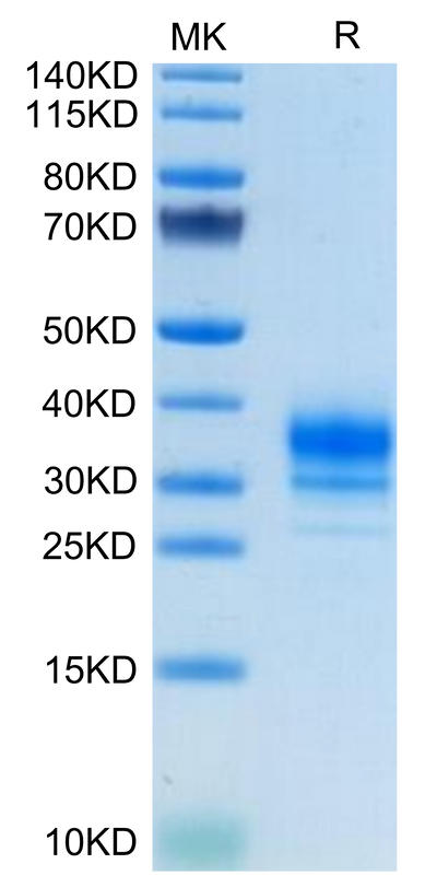 Human FOLR2 on Tris-Bis PAGE under reduced condition. The purity is greater than 95%.