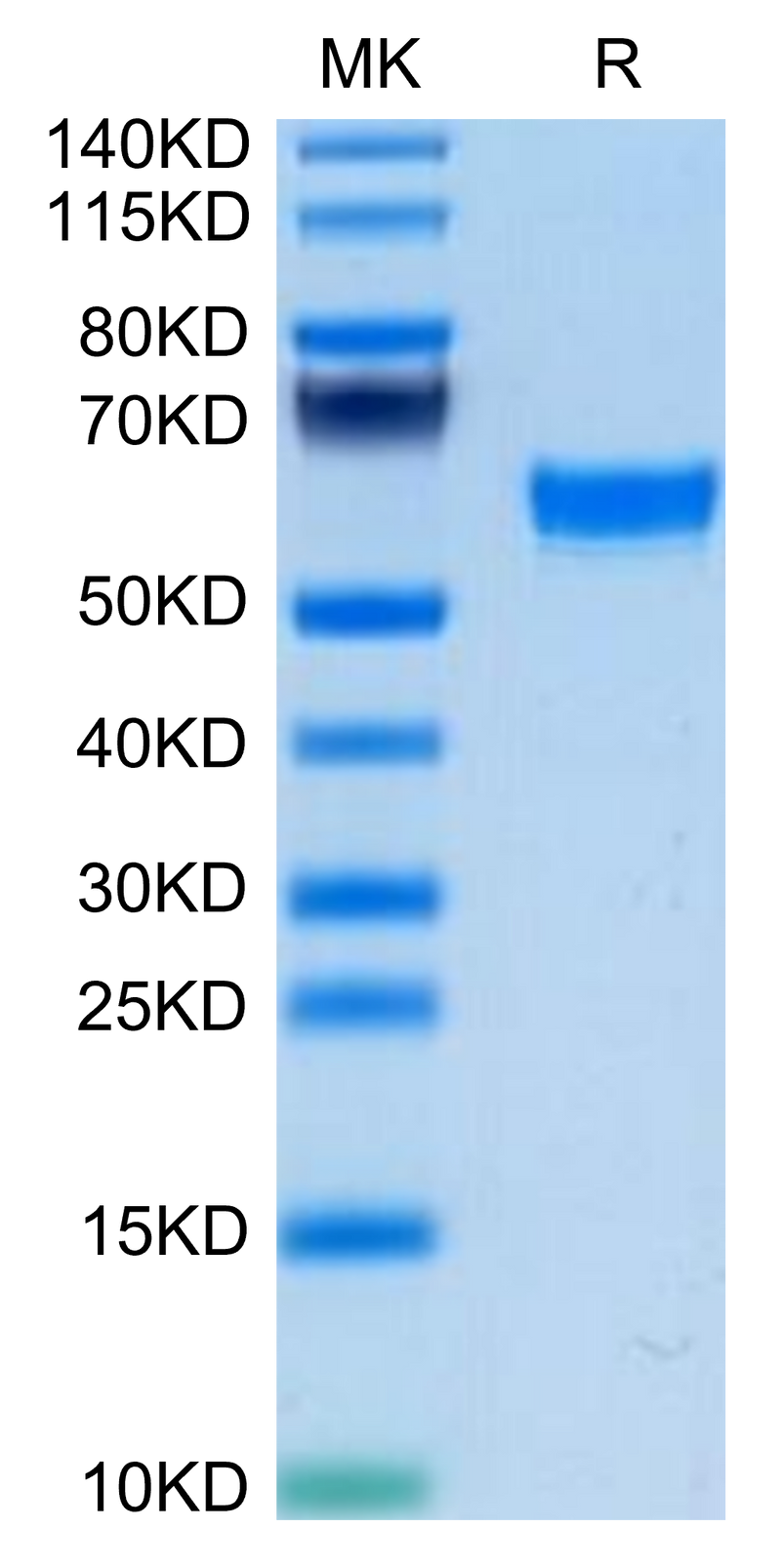 Mouse TNFSF15 on Tris-Bis PAGE under reduced condition. The purity is greater than 95%.