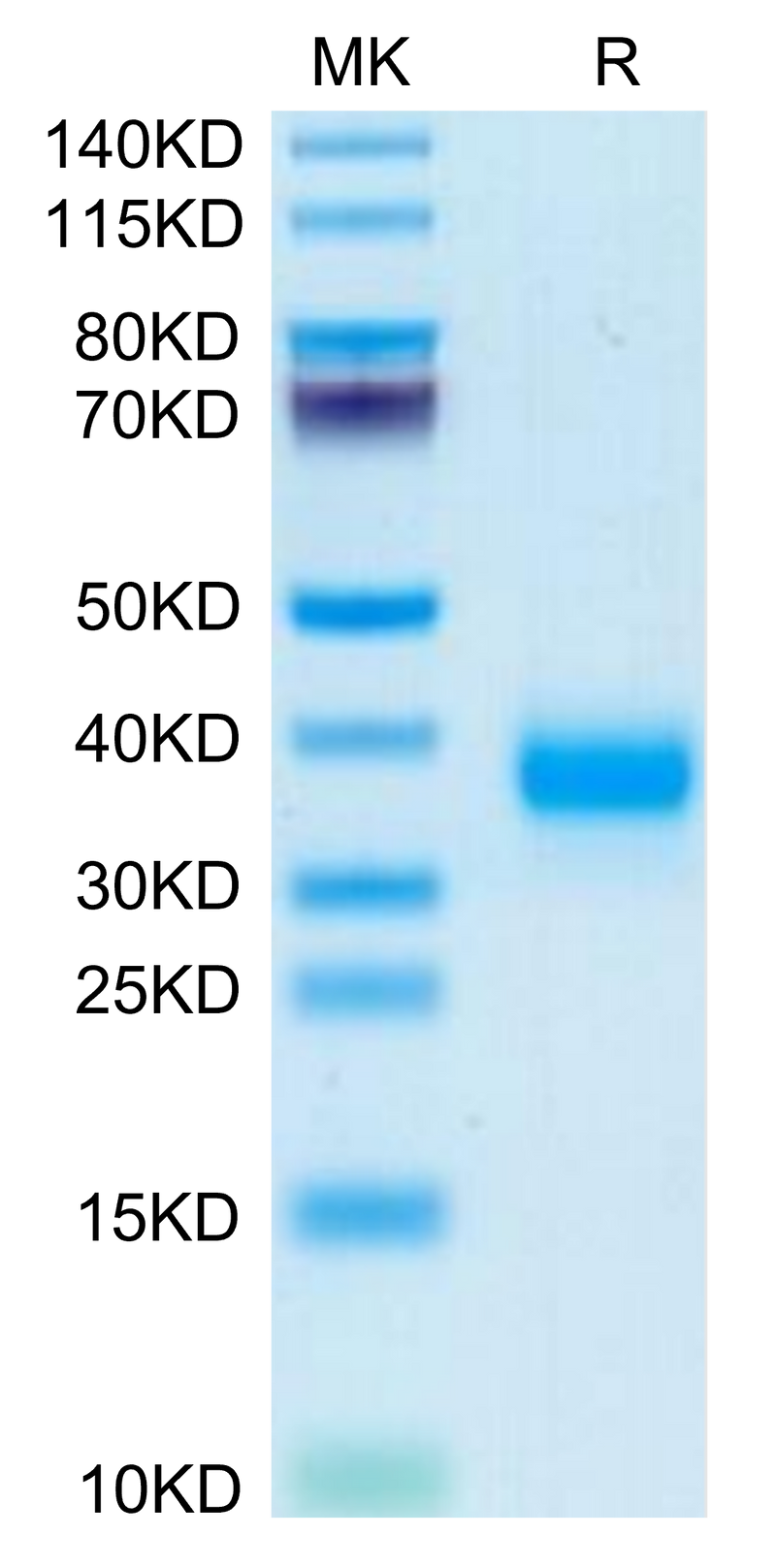 Mouse FOLR4/Juno on Tris-Bis PAGE under reduced condition. The purity is greater than 95%.