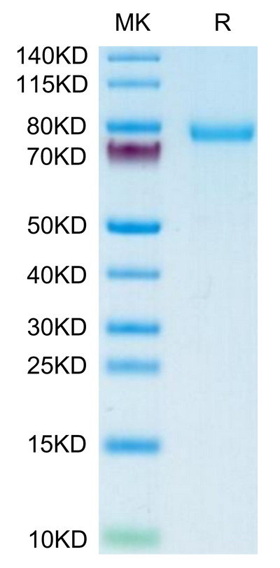 Human DSG-2 on Tris-Bis PAGE under reduced condition. The purity is greater than 95%.