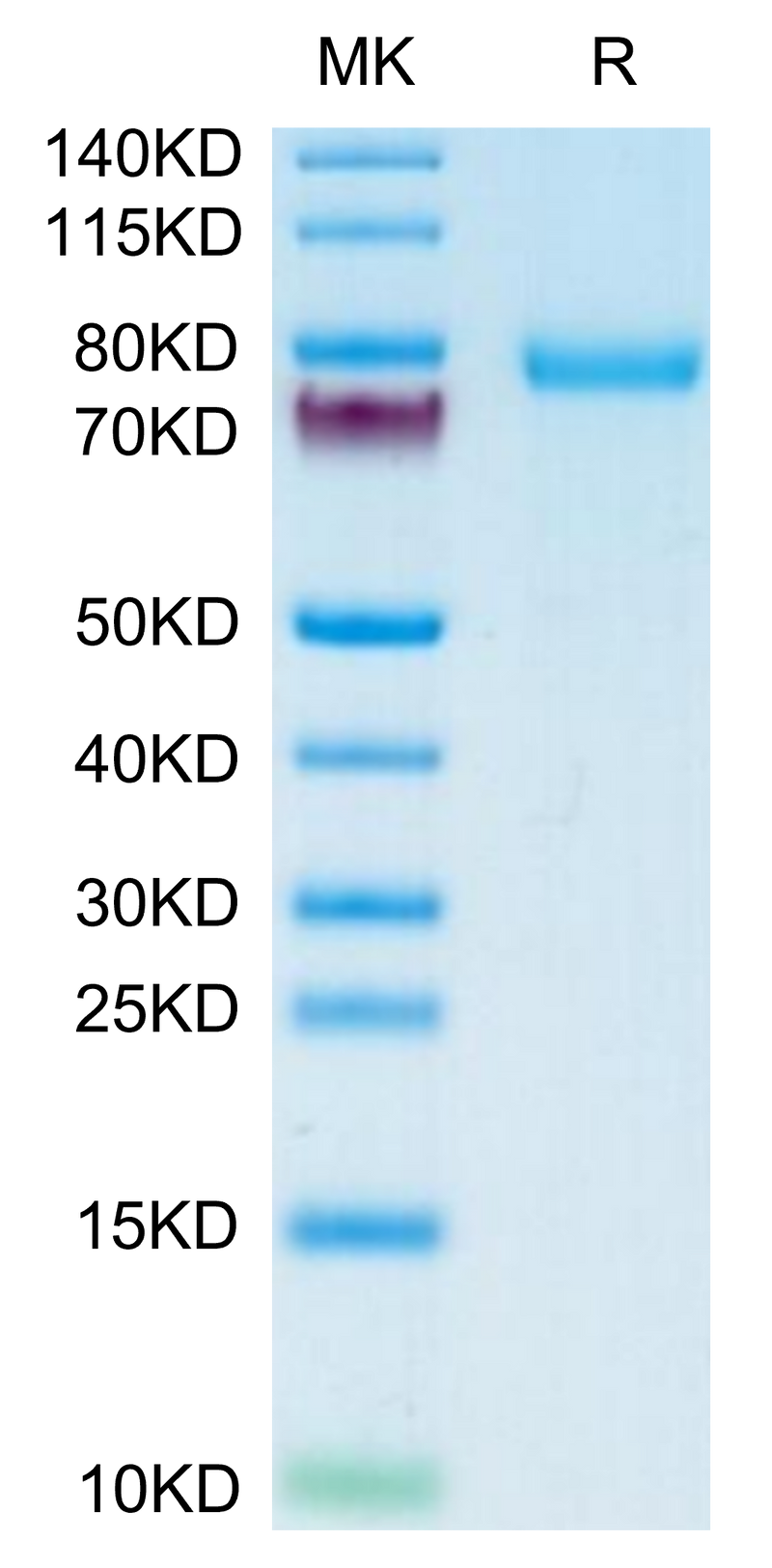 Human DSG-2 on Tris-Bis PAGE under reduced condition. The purity is greater than 95%.