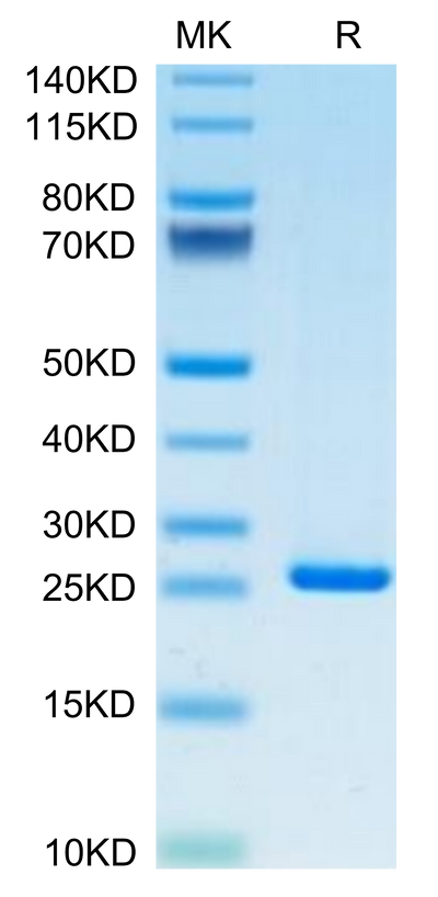 Human CRP on Tris-Bis PAGE under reduced condition. The purity is greater than 95%.