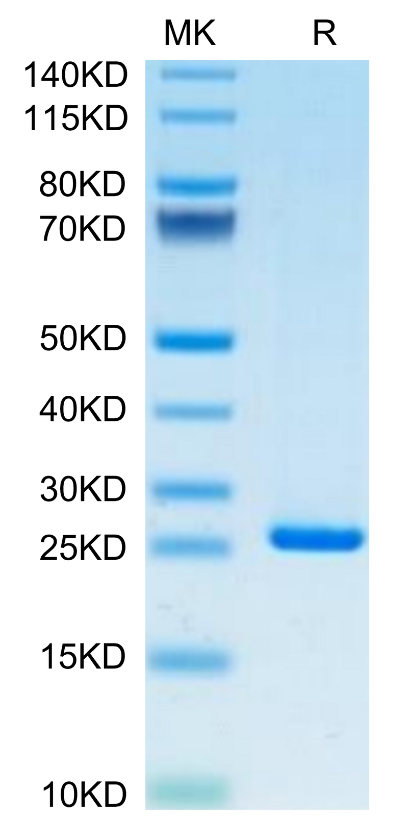 Human CRP on Tris-Bis PAGE under reduced condition. The purity is greater than 95%.