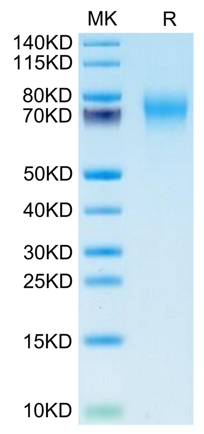 Biotinylated Human FGFR2 alpha (IIIc) on Tris-Bis PAGE under reduced condition. The purity is greater than 95%.