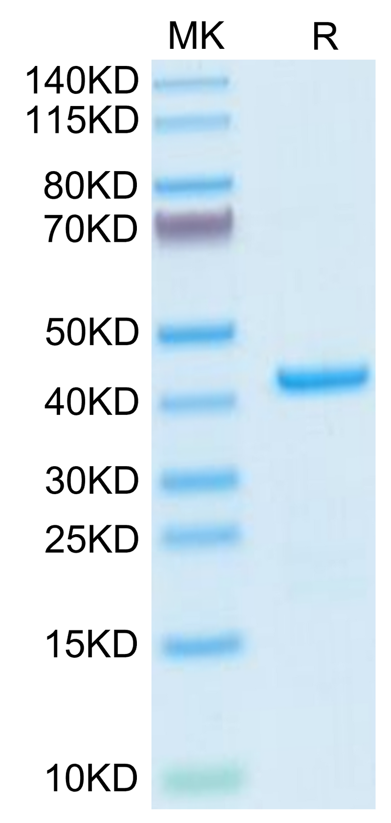 Human EMAP-II on Tris-Bis PAGE under reduced condition. The purity is greater than 95%.