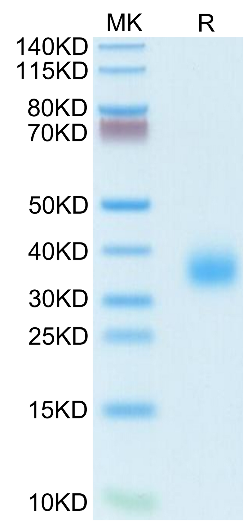 Human/Cynomolgus/Rhesus macaque ROR1 (39-151, Ig-like Domain) on Tris-Bis PAGE under reduced condition. The purity is greater than 95%.